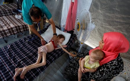 އެކަށީގެންވާ ކާނާ ނުލިބި ޣައްޒާގައި ތުއްތުކުދިން މަރުވާން ފަށައިފި, 335,000 ކުދިން މަރުގެ ތުންފަތް މަތީގައި